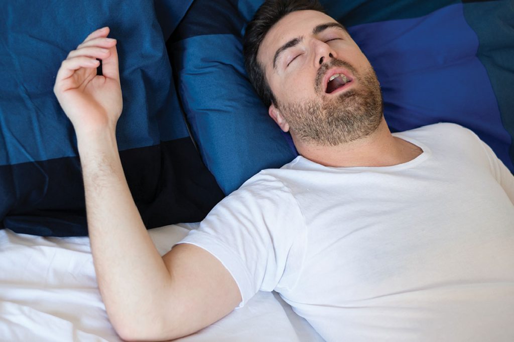 Síndrome de Apnea obstructiva del sueño