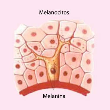 Cáncer Melanoma