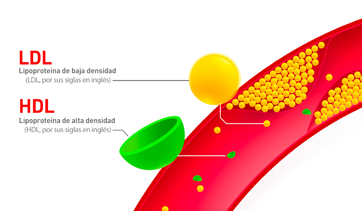 El Significado Del Colesterol LDL Y HDL - Relevancia Médica